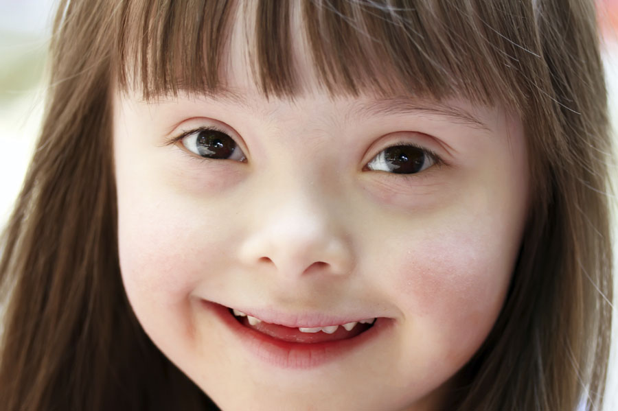 Smiling girl with Down syndrome.